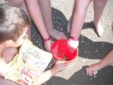 Onlus Associazione di Volontariato Sindrome di Rubinstein-taybi